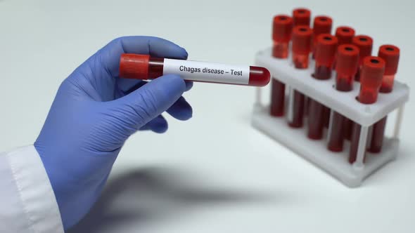 Chagas Disease, Doctor Shows Blood Sample in Tube, Lab Research, Health Checkup