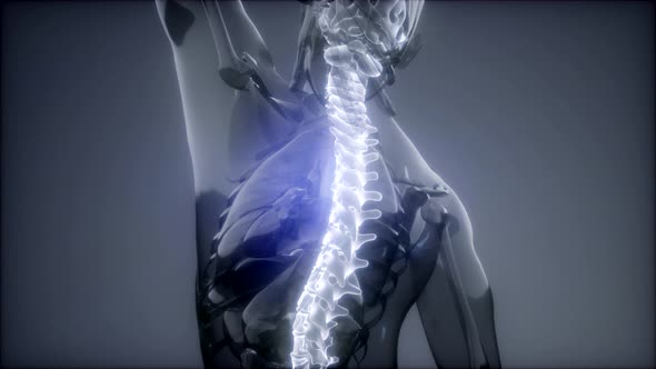 Backache in Back Bones alt