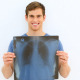 Smiling Patient Showing His Positive Xray - VideoHive Item for Sale