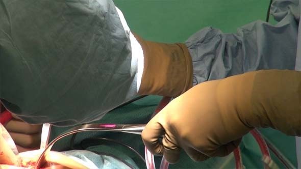 Hip Replacement and Doctor's Hands 1