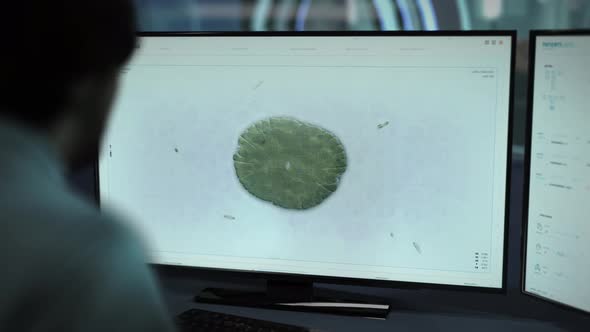 Medical Software is analyzing the microorganism division at the laboratory alt