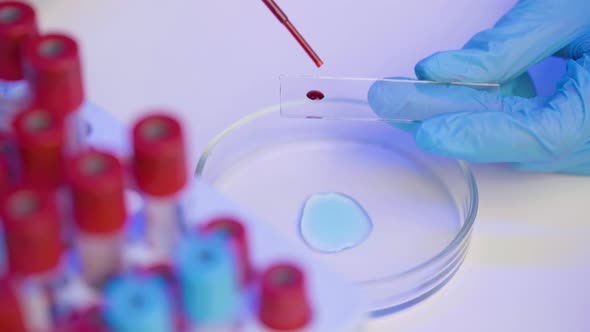 Lab Assistant Putting Drop of Blood on Glass Slide for Test Close Up