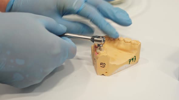 Dental Prosthetist in Rubber Gloves Showing Crown Installation Process on Human Jaw Layout