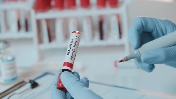 The Doctor Holds Hand Laboratory Positive Blood Test Tube for Plague