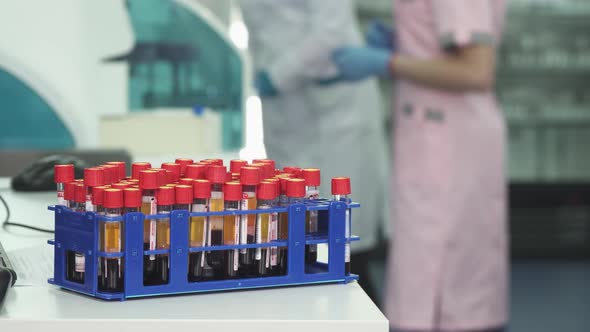 Test Tubes with Blood Samples at the Medical Laboratory