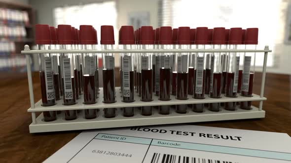 Blood Test Is Negative and Need To Stay Home alt