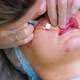 The Cosmetologist Makes Injections on the Client's Face in the Lip Area - VideoHive Item for Sale