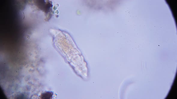 microscopic shrimp under the microscope
