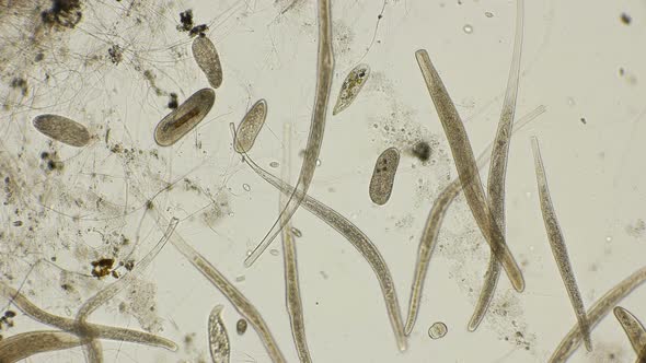 Colony Infusorium Spirostomum With an Elongated Body