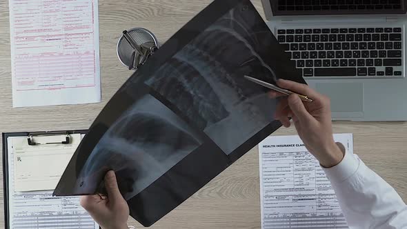 Pulmonologist Carefully Examining Patients Lungs X-Ray, Noting Suspicious Areas