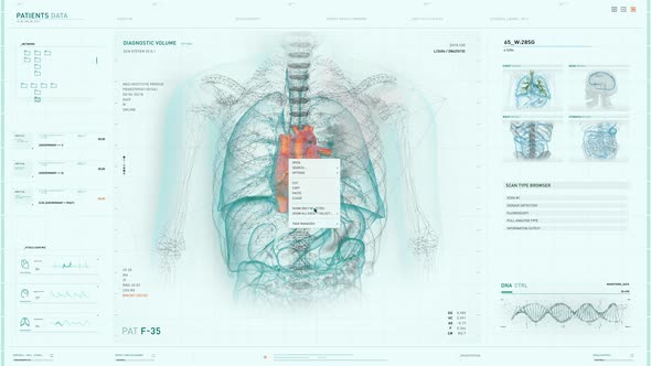 Advanced medical scanner detects cardiac ischemia disease in the patients heart alt