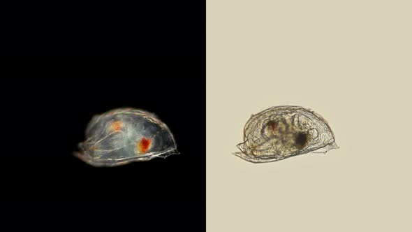 Young Ostracode Halocyprida Under the Microscope, Phylum: Arthropoda, Subclass: Myodocopa