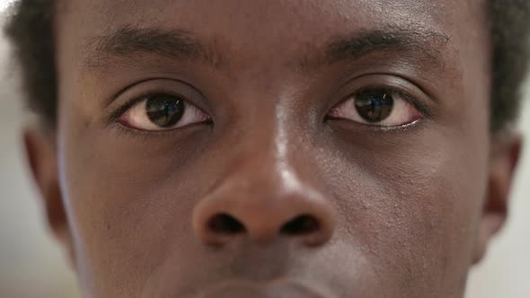 Blinking Eyes Young African Man Looking at the Camera