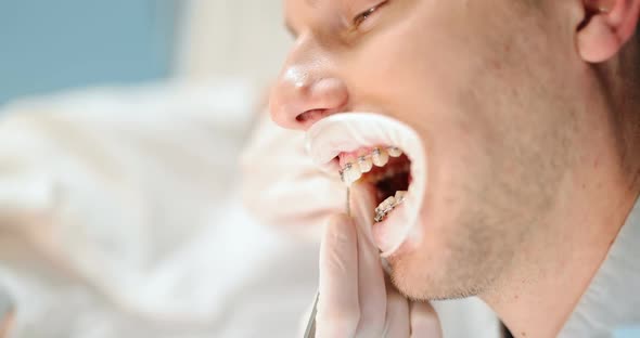 Dentist and Patient During an Orthodontic Treatment