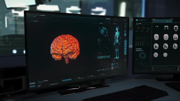 Scanner Software Interface Checks Human Head Examination Detecting Brain Tumor alt