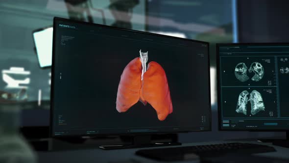 X-ray diagnosis software identifies disease cells in the patients lung organ alt