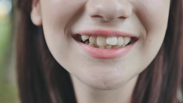 A Teenage Girl Demonstrates Her Crooked Teeth