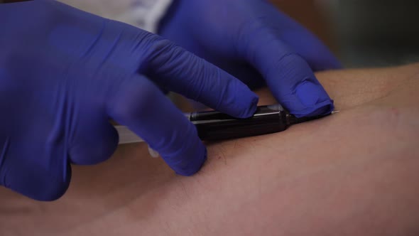 Closeup of Sampling Blood From a Vein By a Doctor in Blue Medical Gloves