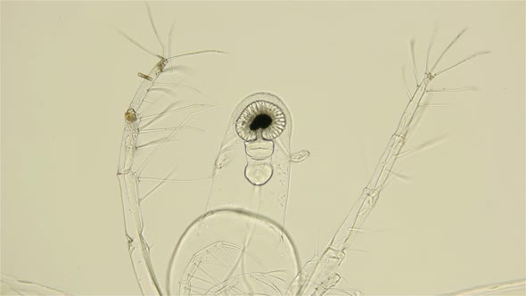 Zooplankton Under a Microscope