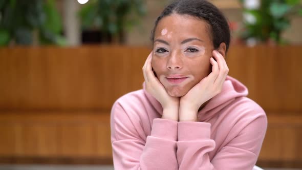 Black African American Woman with Vitiligo Pigmentation Skin Problem Indoor Dressed Pink Hoodie