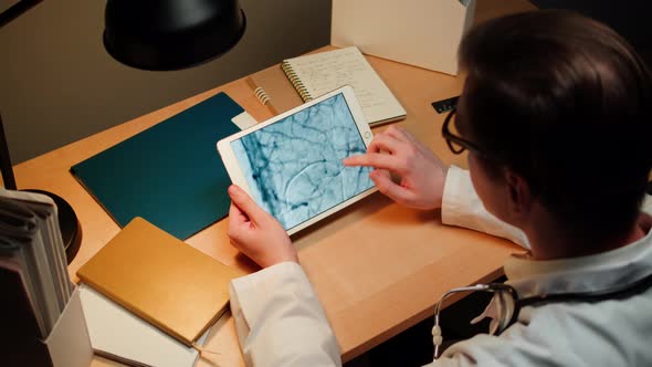 Doctor Examining Blood Vessels Xray on Gadget Tablet