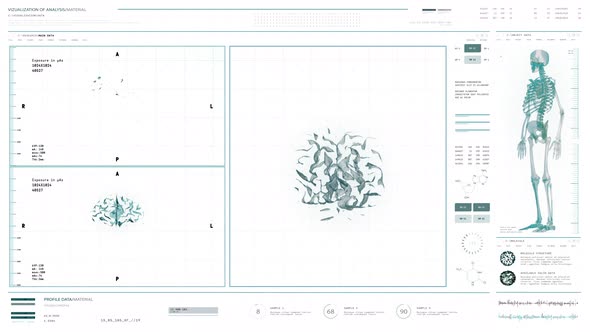 Medical system is analyzing the tumor of the patients brain for cancer treatment alt