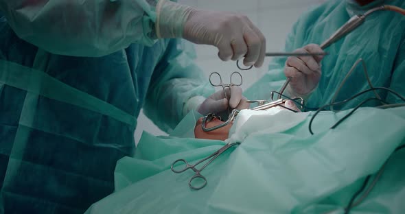 The Doctor Performs a Pediatric Surgical Operation to Remove the Tonsils