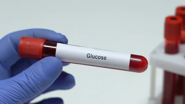 Glucose, Lab Worker Holding Blood Sample in Tube Close-Up, Health Check-Up