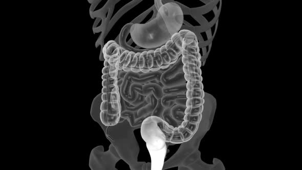 Colonoscopy is the visualization of the large intestine with a tube called a colonoscope.