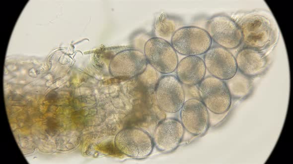 Eggs of a Water Bear Tardigrada 