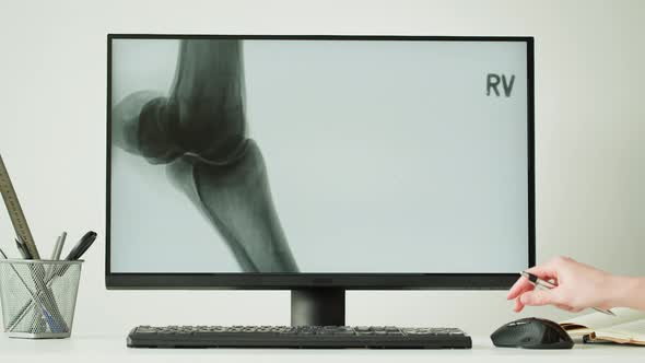 Doctor Veterinarian Examining Horse Leg Skeleton Roentgen on Computer Monitor