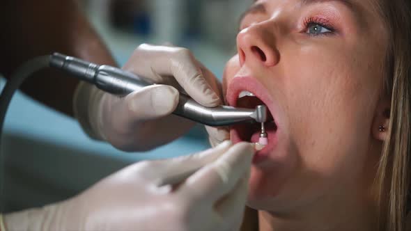 Close Up View of Dental Procedure of Whitening