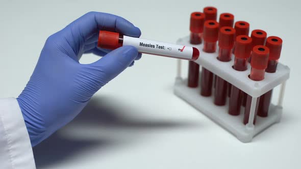 Positive Measles Test, Doctor Showing Blood Sample, Lab Research, Health Checkup