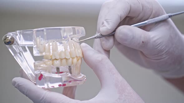 Dentist holding tooth model. Dentist holding the stick and pointing at the teeth model