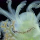 Worm Polychaeta of the Family Terebellidae Under the Microscope Has Dichotomous Branchials That Look - VideoHive Item for Sale