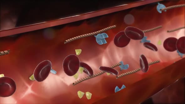 Pancreatic -Cell Electrical Activity and Insulin Secretion