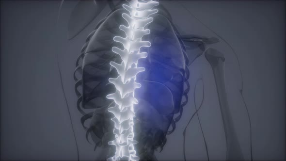 Backache in Back Bones alt