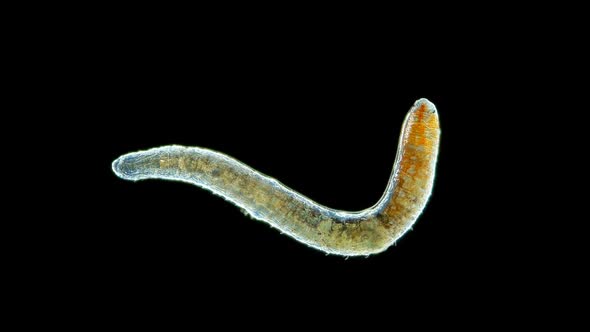 Worm Nais Sp. Under a Microscope, Family Naididae, a Class of Oligochaeta