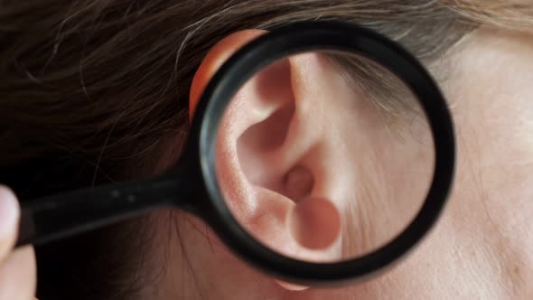 Dermatologist Examines a Large Mole in the Patient's Ear Using a Magnifying Glass