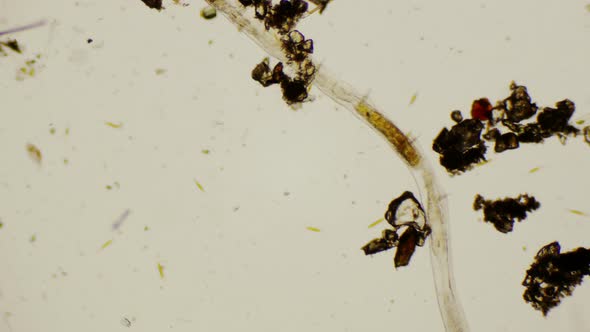 Nematode Under The Microscope