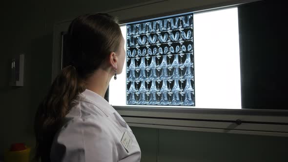 Doctor Looks at X-ray with Negatoscope