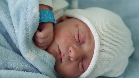 Newborn Baby Face Portrait Acne Allergic Irritations Early Days Sleeping On Blue Background