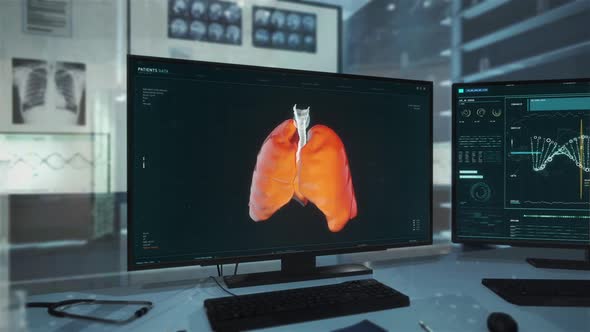 CT Chest Results Of The Patient Are Analyzing In Modern Computer Software alt