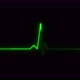 Concept 5-E1 Realistic Heart Pulse Monitor Animation - VideoHive Item for Sale