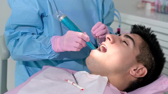 Close Up of Dentist Using Dental Curing UV Lamp on Teeth of Patient