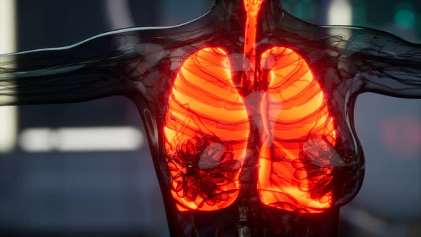 Human Lungs Radiology Exam in Laboratory alt