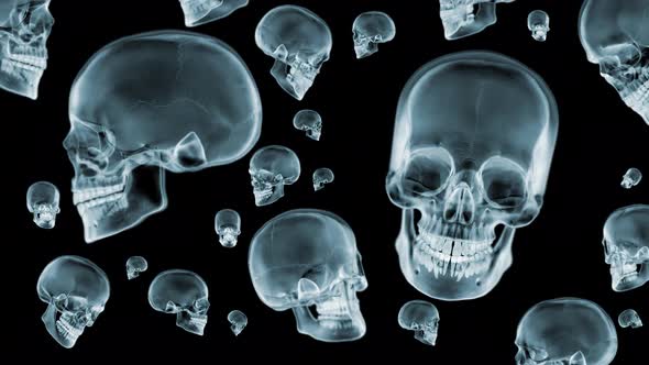 Skulls X-Ray spinning loop