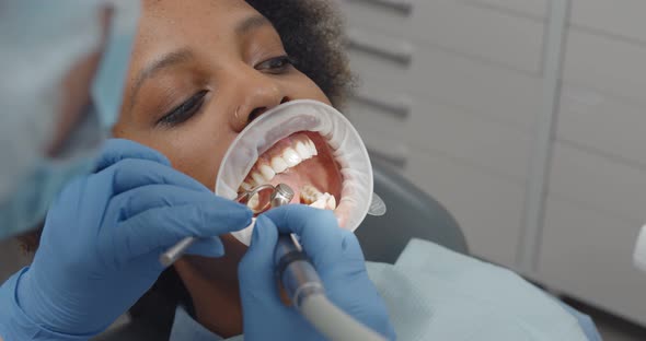 African Woman Patient with Retractor in Open Mouth Checked By Dentist