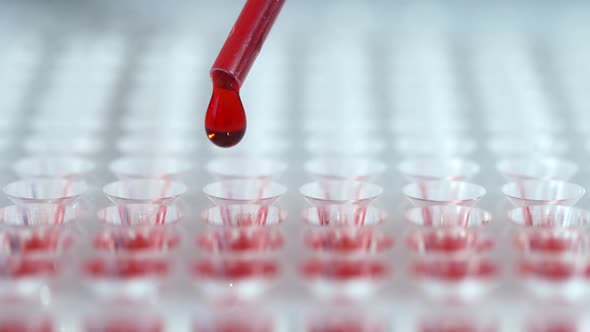 Lab Technician Performs a Blood Test in the Laboratory