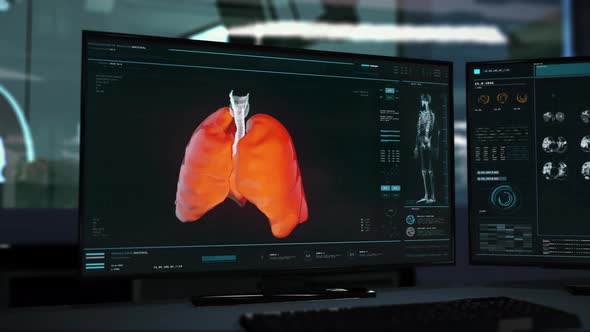 Medical analysis tech spotted the illness bacteria inside of the patients lungs